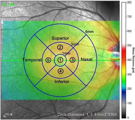 thickness measurement of retina|average retinal thickness.